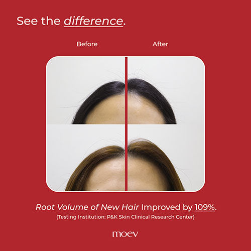 MOEV Annurcatin Shampoo 300ml