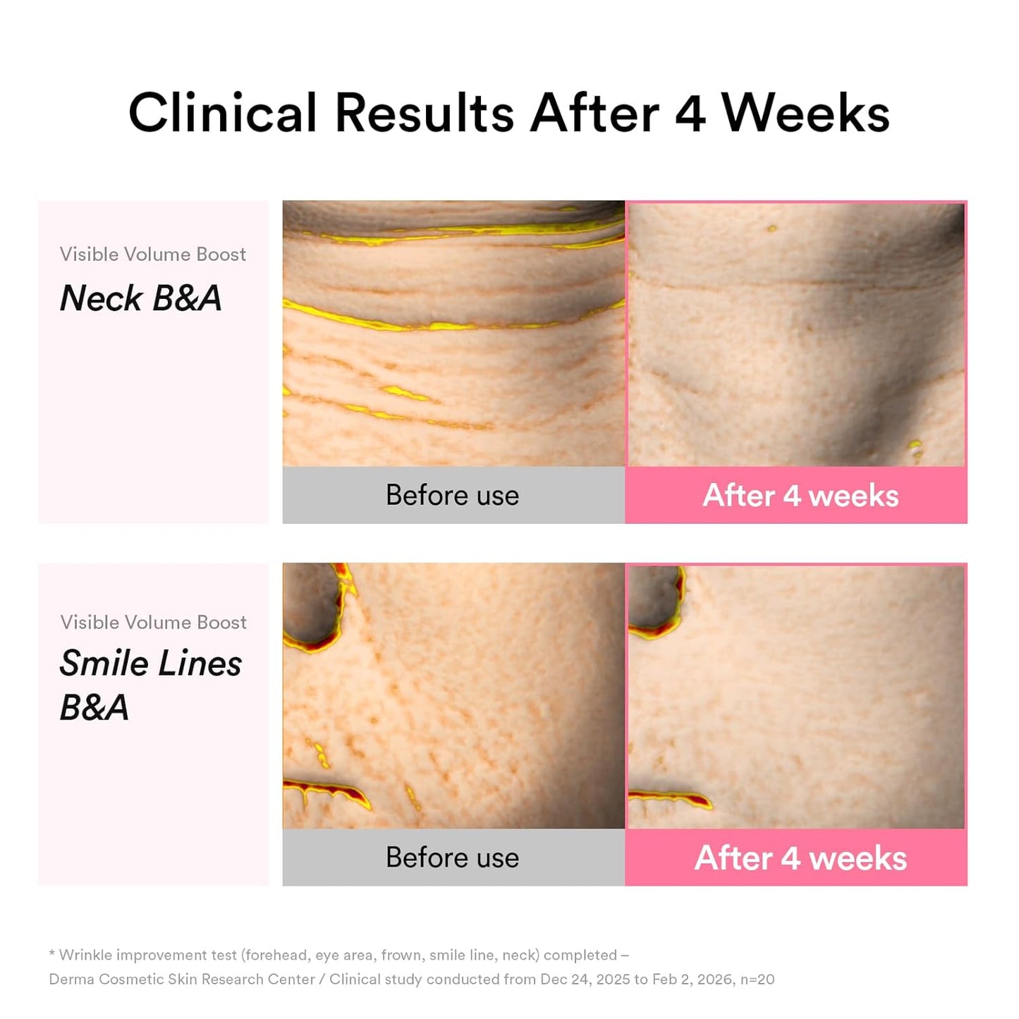 ABIB PDRN Volume Fill-it Booster Cream 2.5 Tube [30ml]