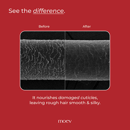 MOEV Annurcatin™ Treatment 200ml