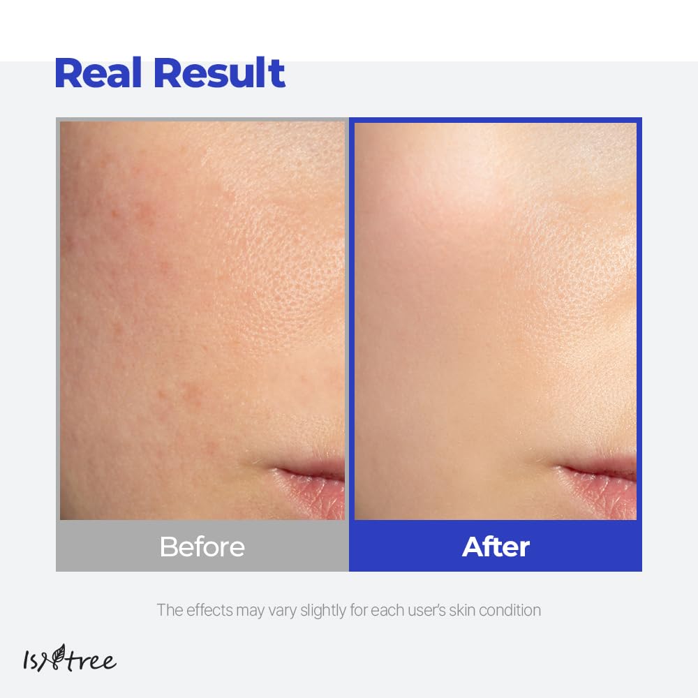 IsNtree Hyaluronic Acid Aqua Gel Cream 100ml