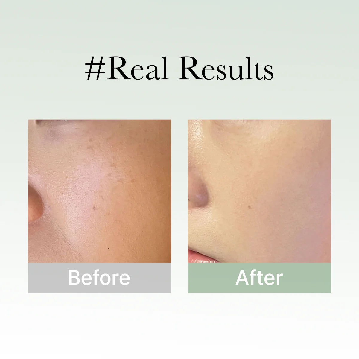 Arencia Hyssop Serum 30 50g