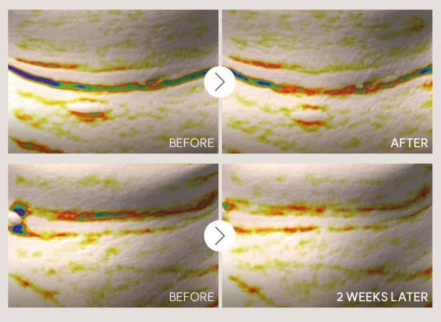 Marshique Wrinkle Repair Hydrogel Neck Patch [4 Sheets]