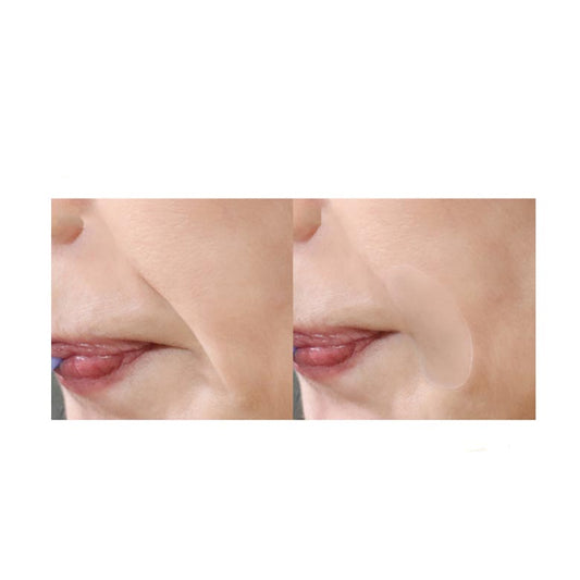 Marshique Wrinkle Repair Nasolabial Fold Patch (60 Patches)
